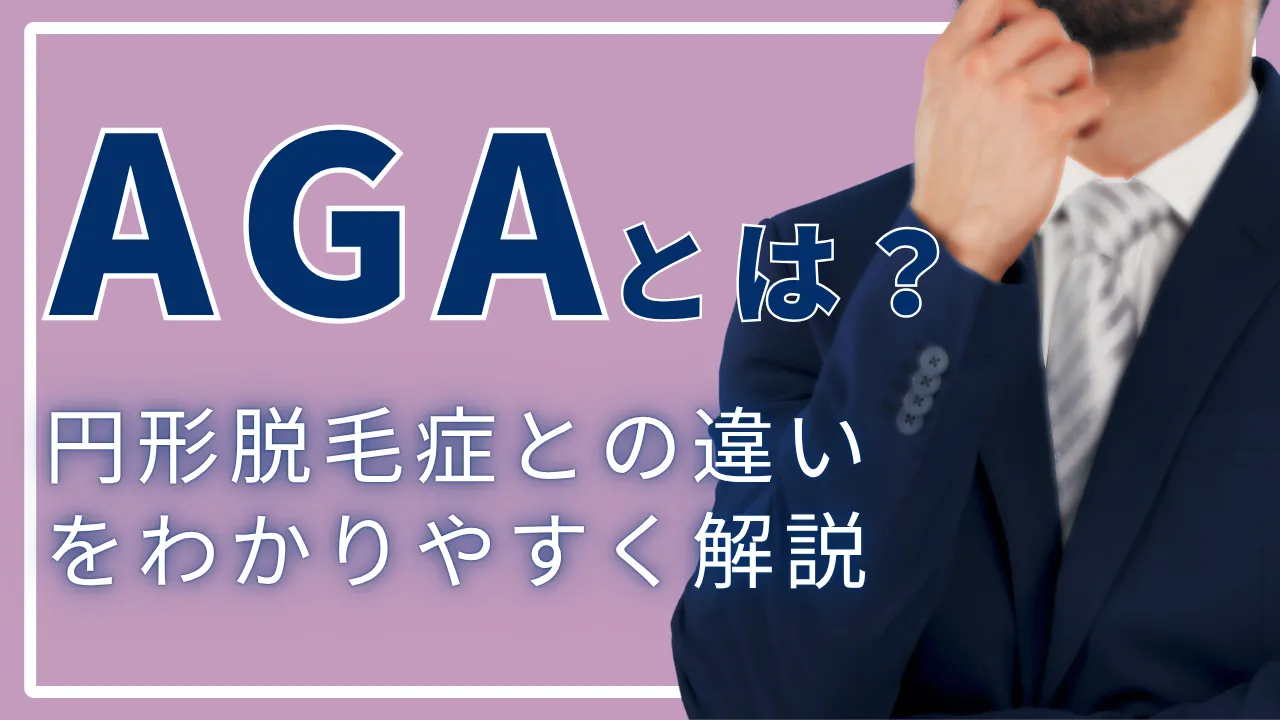 AGAとは?加齢による薄毛・円形脱毛症との違いをわかりやすく解説