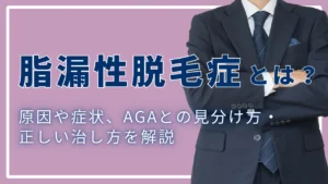 脂漏性脱毛症とは？原因や症状、AGAとの見分け方・正しい治し方を解説