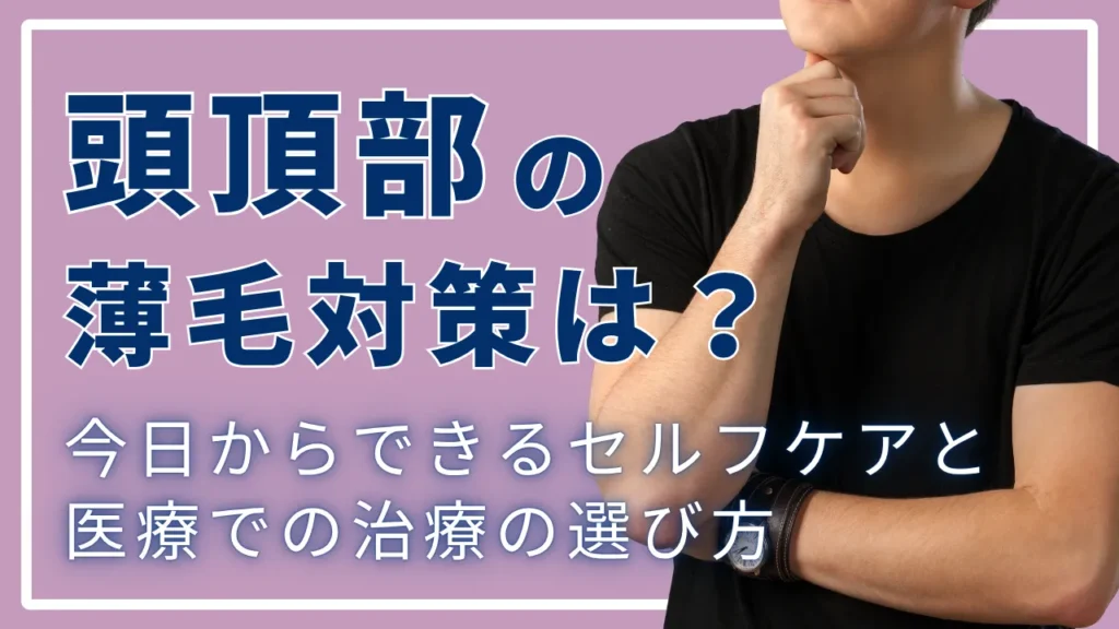 頭頂部の薄毛対策は？今日からできるセルフケアと医療での治療の選び方
