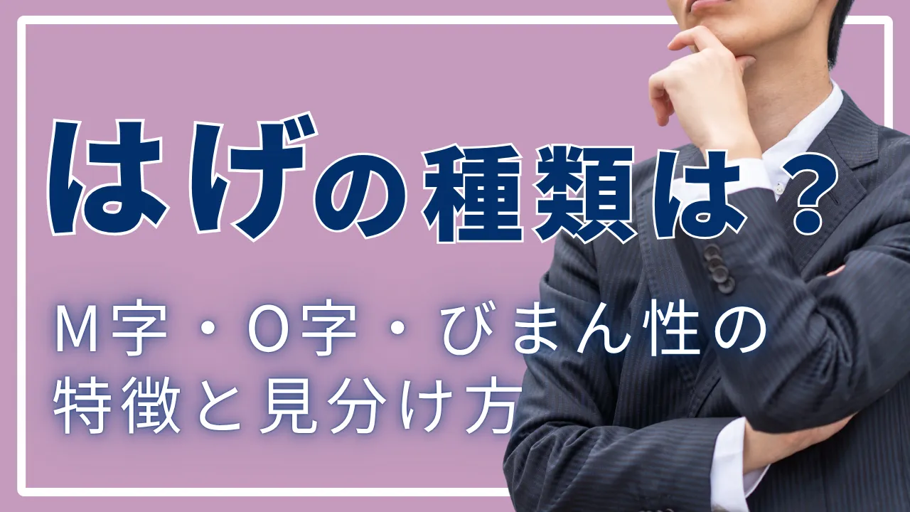 はげの種類は?M字・O字・びまん性の特徴と見分け方