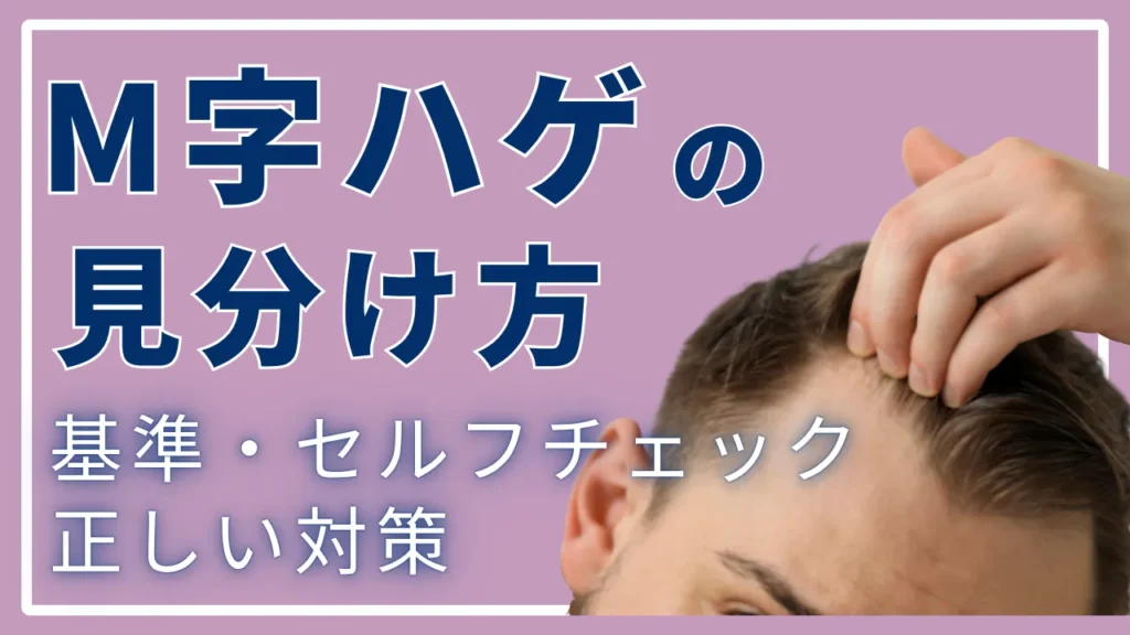 M字はげの見分け方は？基準・セルフチェックと正しい対策を解説