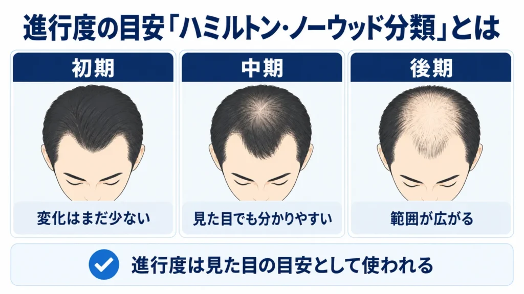 進行度の目安「ハミルトン・ノーウッド分類」とは